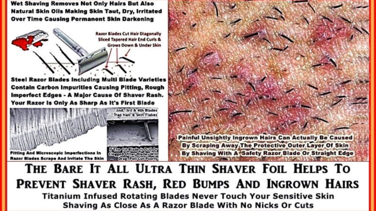 Herpes or Ingrown Hair